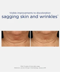 קרם צוואר ממצק מיקרו פפטיד 229 Triple Firming Neck Cream with MicroDiPeptide229 80g